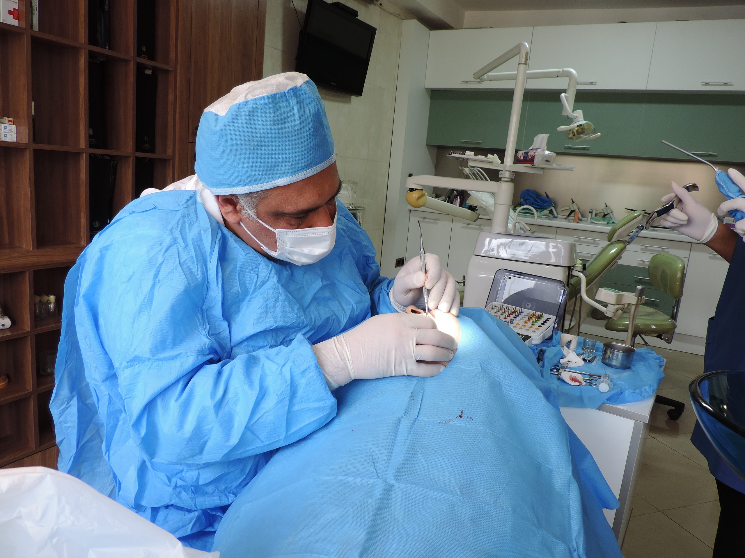 کامپوزیت ونیر