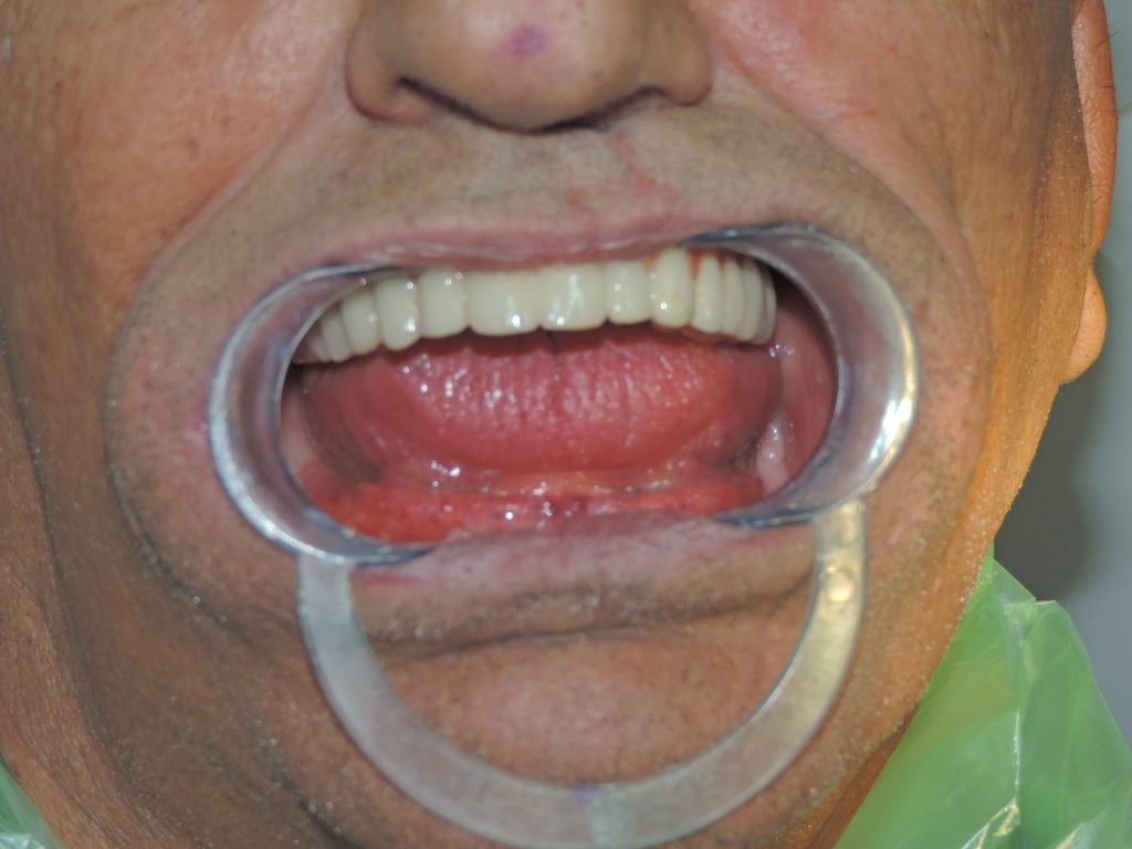 شیوه صحیح مسواک زدن