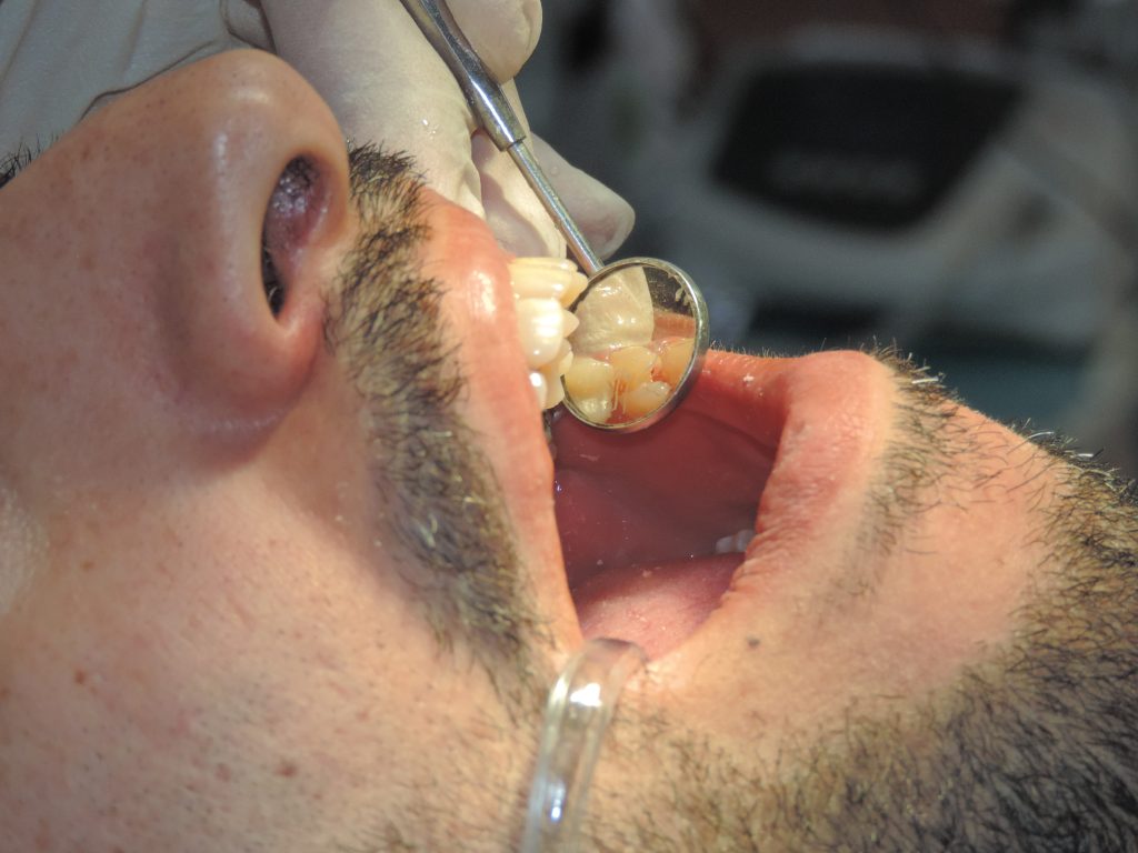 مراقبت های بعد از جراحی