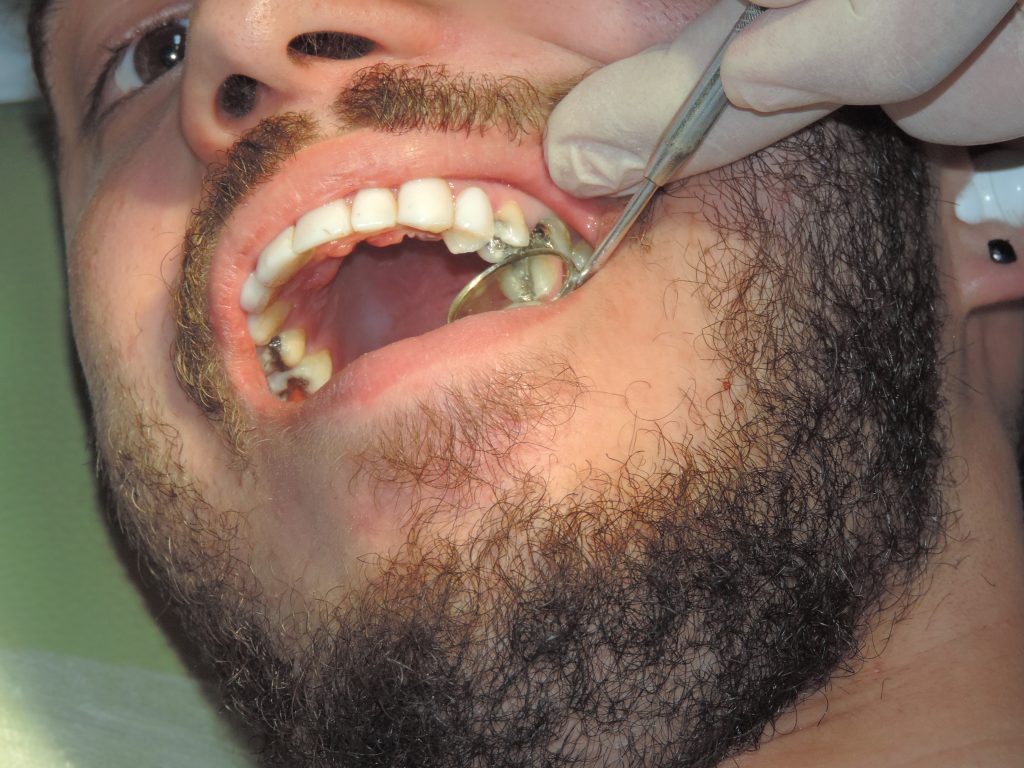 نکاتی برای داشتن لبخندی سالم